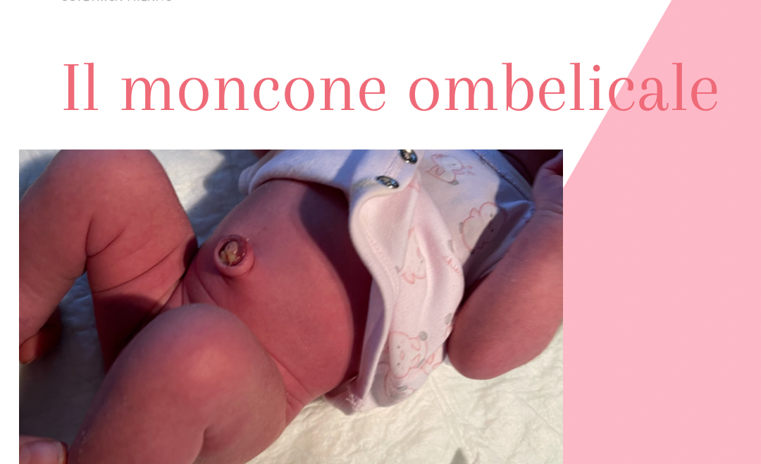 IL MONCONE OMBELICALE