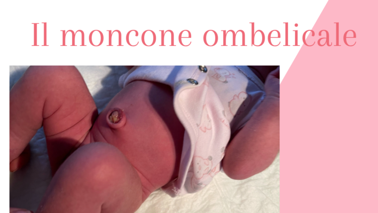 IL MONCONE OMBELICALE